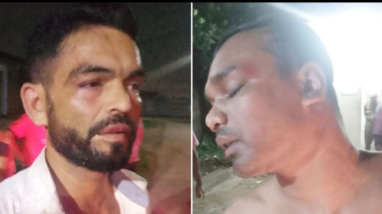 সিইউএফএলে ট্রাকচালকদের সঙ্গে সংঘর্ষ, আহত ২ আনসার সদস্য
